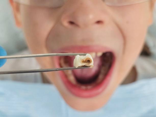 Best Emergency Cosmetic Dentistry in Ruckersville, VA