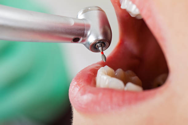 Best 24-Hour Emergency Dentist in Ruckersville, VA